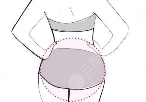 人鱼体雕可以维持多久？