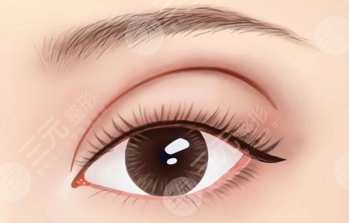 刘辅容双眼皮修复怎么样？