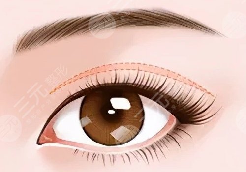 刘辅容双眼皮修复怎么样？