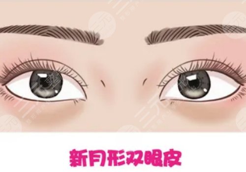 刘志刚眼修复做的怎么样?