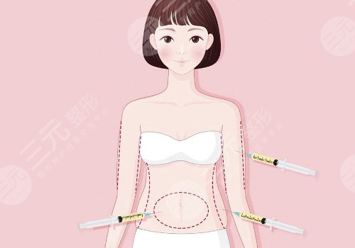 人鱼体雕和普通吸脂区别