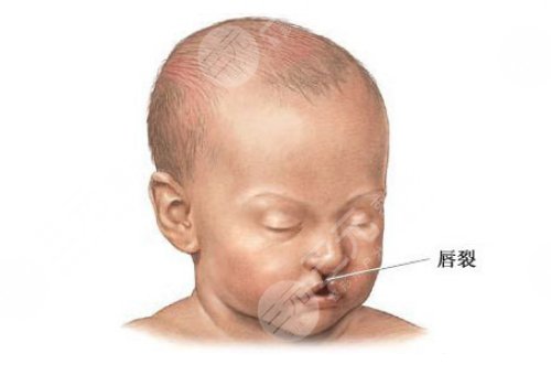 杭州儿童医院有整形科吗