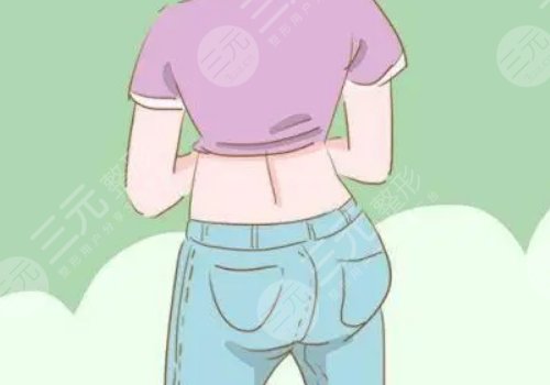 妈妈臀吸脂多久可以恢复？