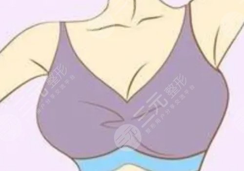 曼托水滴255cc隆胸小吗