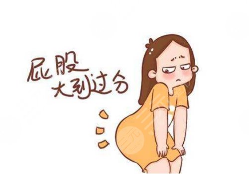 妈妈臀吸脂费用大概多少?