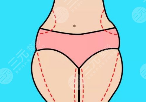 人鱼体雕的副作用