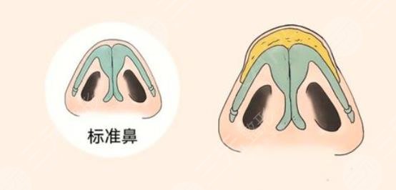 鼻尖