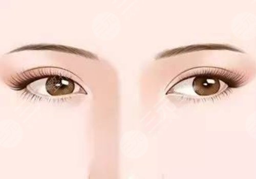 曹仁昌修复眼睛真的厉害吗？