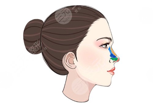 翘鼻和直鼻哪个好看