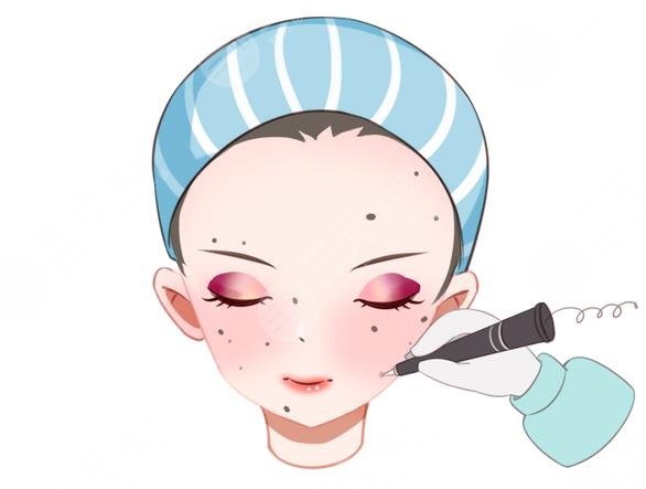 上海华山医院祛斑案例