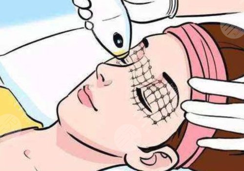 以色列飞顿热拉提plus作用原理是什么？