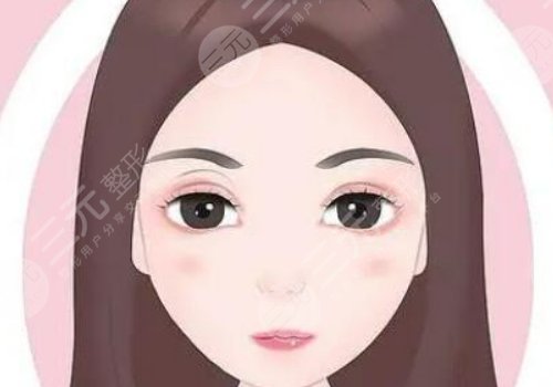 何文星修复双眼皮怎么样