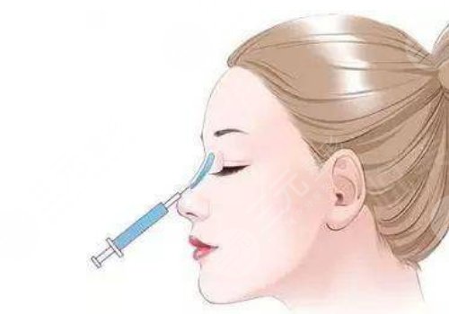 广州颜玲做鼻子如何？