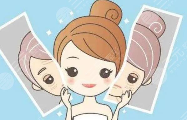 北部战区总医院光子嫩肤案例