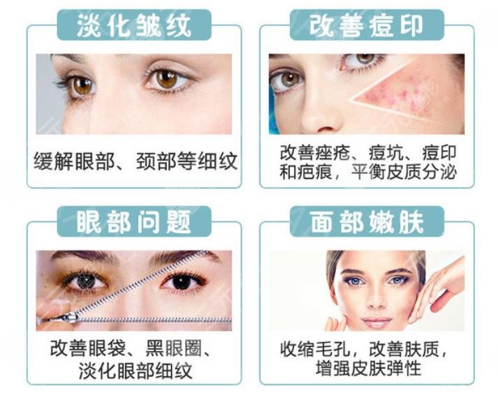 光子嫩肤m22和opt的区别