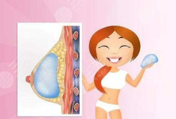 德美假体可以终身不取吗？放在身体一辈子会怎么样？乳腺专家回答