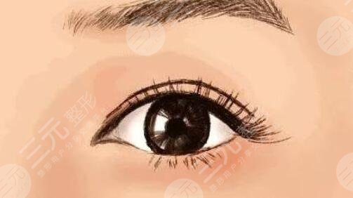 开眼角