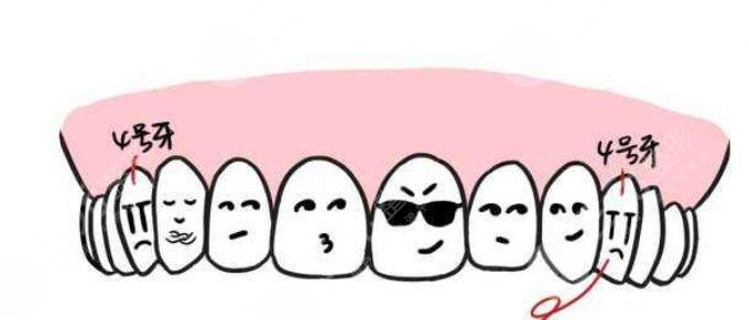 牙齿矫正