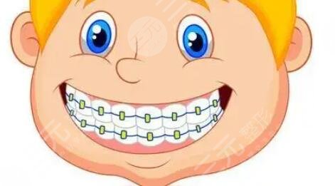牙齿矫正