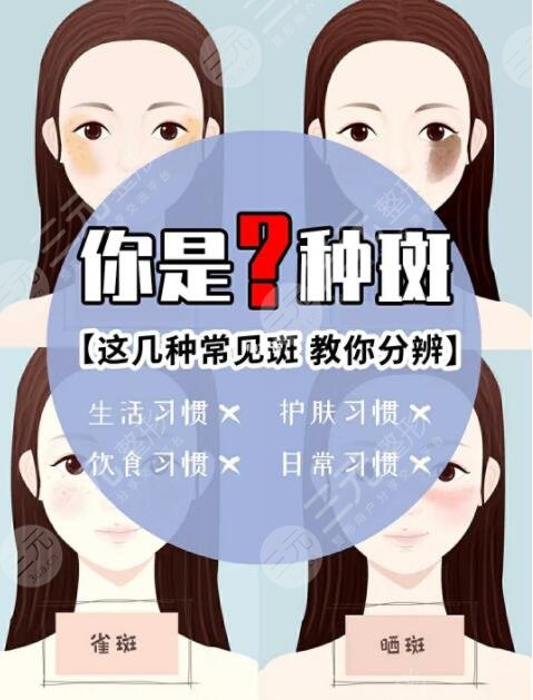 北京朝阳医院整形外科祛斑案例