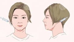 改良下巴有哪些整形项目？这3种可以做，重塑美学轮廓！