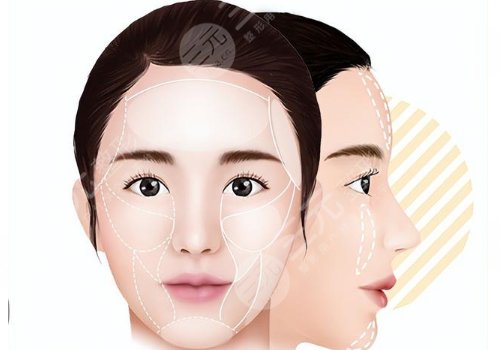 馒化针是什么产品