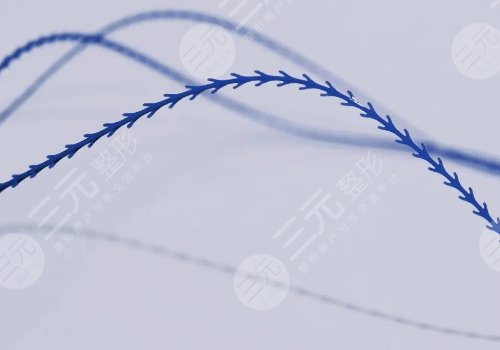 美国强生鱼骨线雕能维持多久