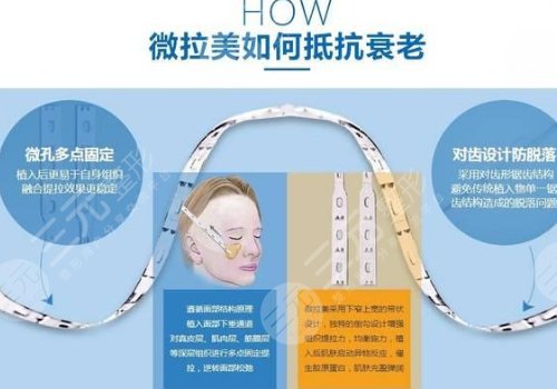 微拉美提升能保持几年