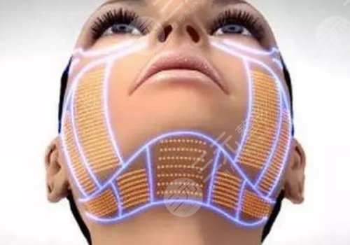 光电抗衰有没有副作用