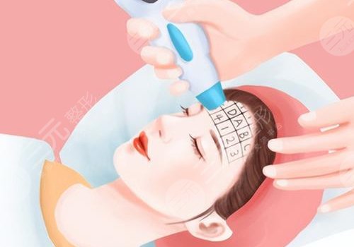 光电抗衰有没有副作用?