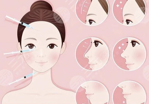 馒化针几天看到效果