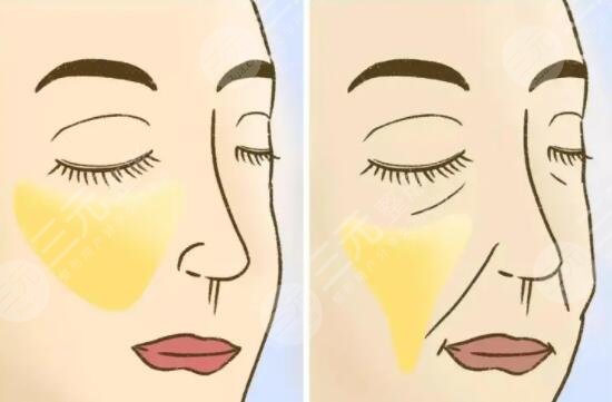 刚医生擅长项目介绍