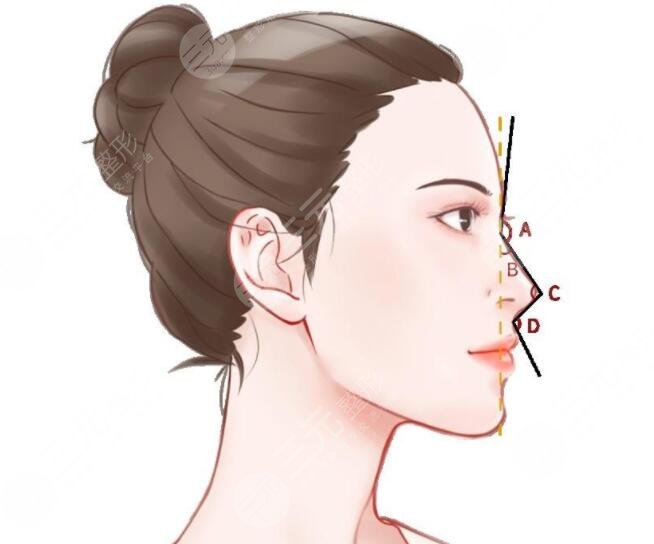 综合鼻和肋骨鼻有什么区别？不仅是材质、效果、适用范畴的区别~