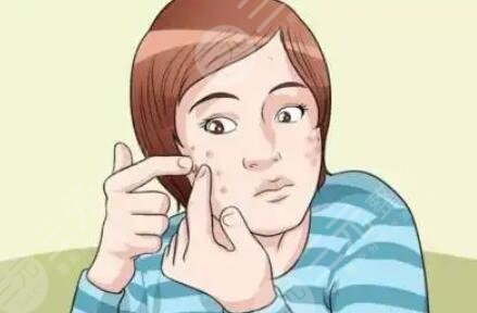 北京美莱医疗美容祛痘案例分享