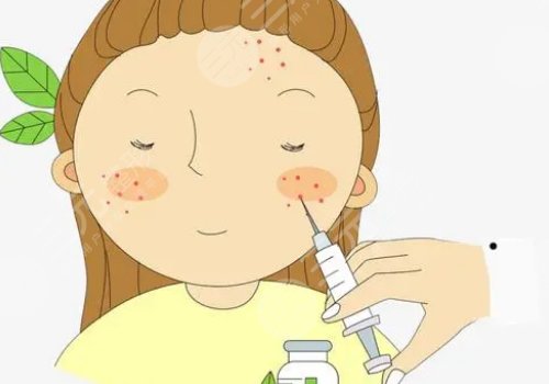 馒化针是什么针