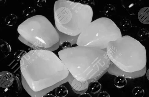 北京协和医院口腔科牙齿贴面案例