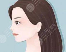 上海柴云医生做的鼻子怎么样?坐诊医院/隆鼻优势/价格公开 上海柴云医生做的鼻子怎么样?坐诊医院/隆鼻优势/价格公开