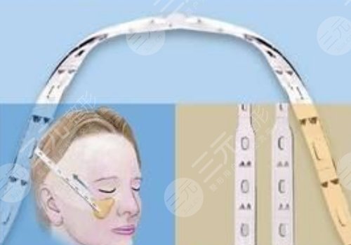 微拉美是什么整容项目