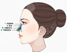 赵耀医生做鼻子怎么样？鼻子整形案例分享/医院信息汇总/2023价格表跟新