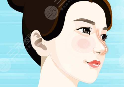 珠江医院陈伯华做鼻子价位