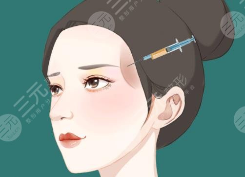 面部填充
