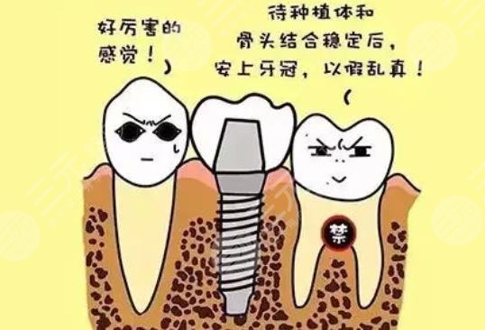 上海第十人民医院种牙案例