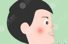 牙齿地包天怎么缓解矫正？正畸原理、价格表分享！