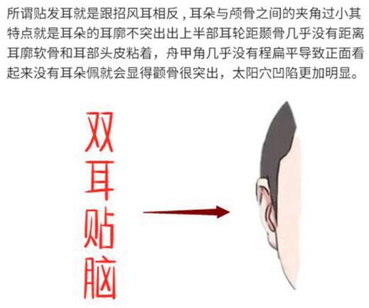 耳基底提升整形怎么做图片科普！微整轮廓美学思路，我来教你~