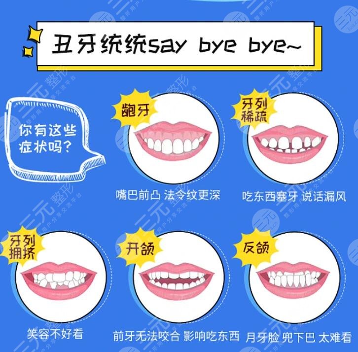 北京东方医院口腔科正畸案例分享