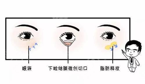 南京去眼袋整形术的费用价格查询！3家靠谱医院可选~