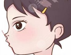 嘴巴歪整形大概多少钱？来了解下价格和嘴巴歪整形的方法有哪些吧