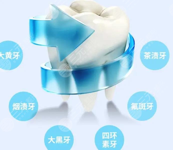 海六院口腔科超声波洗牙案例