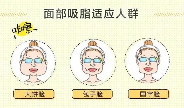 曾海峰面部吸脂科普：