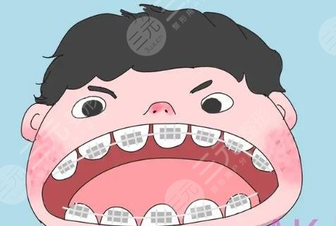 牙齿矫正